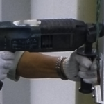 折れた骨を真っ直ぐに！入院3日目、踵に穴をあけ骨を牽引